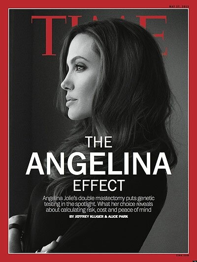 Американский журнал Time опубликовал фото Джоли до операции